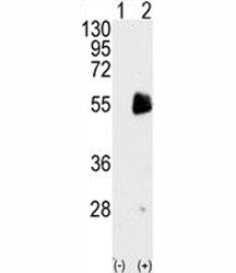 Western blot analysis of PRMT7 antibody and 293 cell lysate either nontransfected (Lane 1) or transiently transfected with the PRMT7 gene (2).~