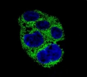 Confocal immunofluorescent analysis of AMACR antibody with HepG2 cells followed by Alexa Fluor 488-conjugated goat anti-rabbit lgG (green). DAPI was used as a nuclear counterstain (blue).