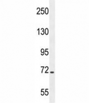 STIM1 antibody western blot analysis in CEM lysate.