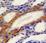 STIM1 antibody immunohistochemistry analysis in formalin fixed and paraffin embedded human kidney tissue.