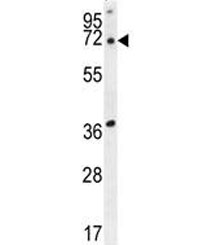ACOT11 antibody western blot analysis in human HepG2 lysate. Predicted molecular weight ~68 kDa.
