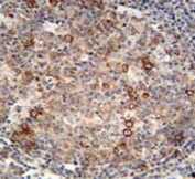 ABCC10 antibody immunohistochemistry analysis in formalin fixed and paraffin embedded human tonsil tissue.