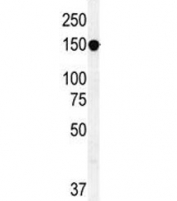 ABCC10 antibody western blot analysis in HepG2 lysate. Predicted molecular weight ~162 kDa.
