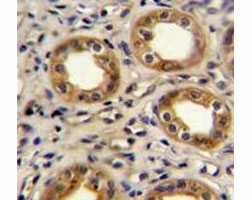 CXCR3 antibody immunohistochemistry analysis in formalin fixed and paraffin embedded human kidney tissue.~