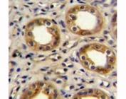 CXCR3 antibody immunohistochemistry analysis in formalin fixed and paraffin embedded human kidney tissue.