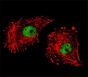 Confocal immunofluorescent analysis of FUS antibody with MDA-MB231 cells followed by Alexa Fluor 488-conjugated goat anti-rabbit lgG (green). Actin filaments have been labeled with Alexa Fluor 555 Phalloidin (red).