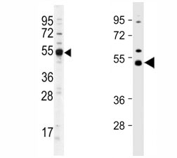 Western blot analysis of Dnmt2 antibody and different lots of mouse cerebellum lysate.~
