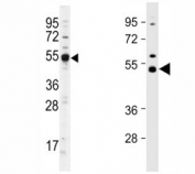Western blot analysis of Dnmt2 antibody and different lots of mouse cerebellum lysate.