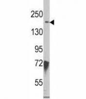 Western blot analysis of JMJD3 antibody and HeLa lysate