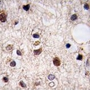 IHC analysis of FFPE human brain tissue stained with JMJD3
