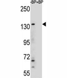 Western blot analysis of JMJD3 antibody and HeLa lysate
