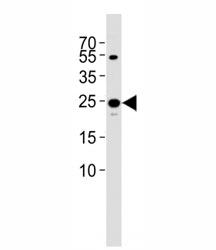 Western blot analysis of lysate from 293T cell line using TFAM antibody diluted at 1:1000. Expected molecular weight: 24~29 kDa.