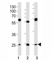 Western blot analysis of lysate from (1) HeLa, (2) HepG2 and (3) U-2OS cell line using TFAM antibody at 1:1000. Expected molecular weight: 24~29 kDa.