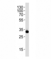 Western blot analysis of lysate from HeLa cell line using RPS6 antibody at 1:1000. Predicted molecular weight ~29 kDa.