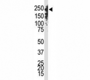 Western blot analysis of Dnmt1 antibody and Jurkat cell lysate. Predicted molecular weight: 180-200 kDa