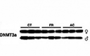 Dnmt3a antibody western blot with irradiated thymus tissue: CT=control mouse; FR=mouse subjected to fractionated exposure; AC=acutely exposed mouse. All sample loading was normalized to protein content.