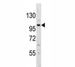 Dnmt3a antibody western blot of Jurkat lysate. Predicted molecular weight: 100-130 kDa~