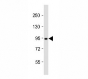 Western blot testing of Dnmt3b antibody at 1:2000 dilution + T47D lysate; Predicted molecular weight: 95 kDa.