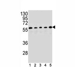 PAX1 antibody western blot analysis in (1) HepG2, (2) MDA-MB453, (3) 293, (4) K562 and (5) MCF-7 lysate. Predicted size 45~55 kDa~