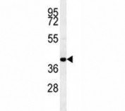 Western blot testing of human MDA-MB-435 cell lysate with CCR8 antibody. Predicted molecular weight ~41 kDa.