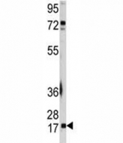 Western blot analysis of UBE2I antibody and A2058 lysate.