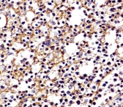 IHC testing of FFPE human tonsil with CD11b antibody. HIER: boil tissue sections in pH6, 10mM citrate buffer, for 10-20 min followed by cooling at RT for 20 min.