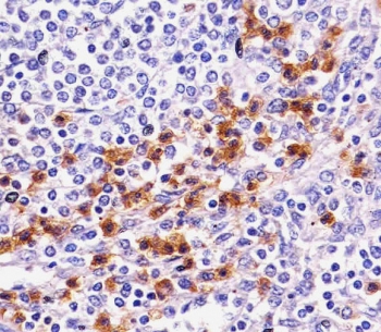IHC testing of FFPE human speen with CD11b antibody. HIER: boil tissue sections in pH6, 10mM citrate buffer, for 10-20 min followed by cooling at RT for 20 min.