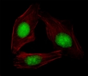 Fluorescent image of U251 cells stained with SREBP2 antibody. Alexa Fluor 488 conjugated secondary (green) was used. Cytoplasmic actin was counterstained with Alexa Fluor 555 (red) conjugated Phalloidin.