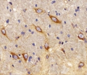 IHC analysis of FFPE rat brain using CB2 antibody at 1:25.