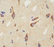 IHC analysis of FFPE human brain using CB2 antibody at 1:25.