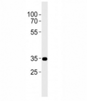 CB2 antibody western blot analysis in A431 lysate. Predicted molecular weight ~38 kDa.