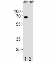 Western blot analysis of ETV5 antibody pre-incubated without (Lane 1) and with (2) blocking peptide in SW480 lysate~