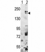 Western blot analysis of SETDB1 antibody and 293 cell lysate either nontransfected (Lane 1) or transiently transfected with the SETDB1 gene (2). Predicted molecular weight ~143 kDa (unmodified) and 170-180 kDa (modified).