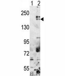 Western blot analysis of SETDB1 antibody and 293 cell lysate either nontransfected (Lane 1) or transiently transfected with the SETDB1 gene (2).