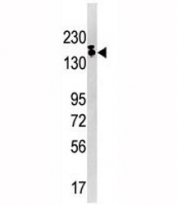 Western blot analysis of SETDB1 antibody and Ramos lysate. Predicted molecular weight ~143 kDa (unmodified) and 170-180 kDa (modified).