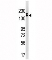 Western blot analysis of SETDB1 antibody and Ramos lysate. Predicted molecular weight ~143 kDa (unmodified) and 170-180 kDa (modified).