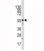 Western blot analysis of Tip60 antibody and mouse liver tissue lysate