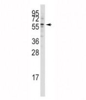 Western blot analysis of Tip60 antibody in Jurkat lysate