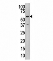 Western blot analysis of Tip60 antibody and CEM cell line lysate