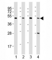 Western blot testing of CTBP1 antibody at 1:2000 dilution. Lane 1: HepG2 lysate; 2: SH-SY5Y lysate; 3: mouse brain lysate; 4: Raji lysate; Predicted molecular weight ~ 48 kDa.