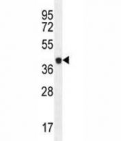 Caspase-5 antibody western blot analysis in MDA-MB231 lysate