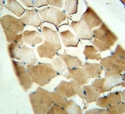 CDKN2C antibody immunohistochemistry analysis in formalin fixed and paraffin embedded human skeletal muscle.