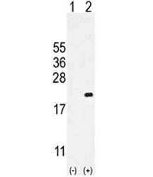 Western blot analysis of CDKN2C antibody and 293 cell lysate either nontransfected (Lane 1) or transiently transfected (2) with the CDKN2C gene.~