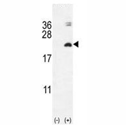 Western blot analysis of IL17F antibody and 293 cell lysate (2 ug/lane) either nontransfected (Lane 1) or transiently transfected with the IL17F gene (2).~