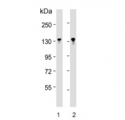 Western blot testing of human 1) Jurkat and 2) MOLT4 cell lysate with BCL11B antibody. Predicted molecular weight ~96 kDa but the modified forms of the protein can be observed at ~130 kDa.