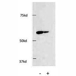 Western blot testing of HDAC1 antibody and HEK293 cells. Knockdown using siRNA showed a significant decrease of specific protein. Predicted molecular weight ~60 kDa