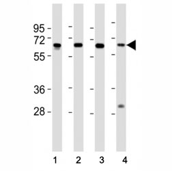 Western blot testing of HDAC1 antibody at 1:2000 dilution. Lane 1: HeLa lysate; 2: Jurkat lysate; 3: K562 lysate; 4: mouse thymus lysate; Predicted molecular weight ~60 kDa