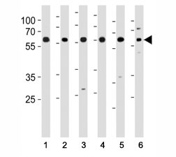 HDAC1 antibody western blot analysis of (1) HeLa, (2) K562, (3) mouse NIH3T3 cell line and (4) mouse testis, (5) rat testis and (6) rat spleen tissue lysate. Predicted molecular weight ~60 kDa~