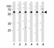 HDAC1 antibody western blot analysis of (1) HeLa, (2) K562, (3) mouse NIH3T3 cell line and (4) mouse testis, (5) rat testis and (6) rat spleen tissue lysate. Predicted molecular weight 55~60 kDa