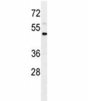 IL1R2 antibody western blot analysis in WiDr lysate. Predicted molecular weight ~ 45 kDa.